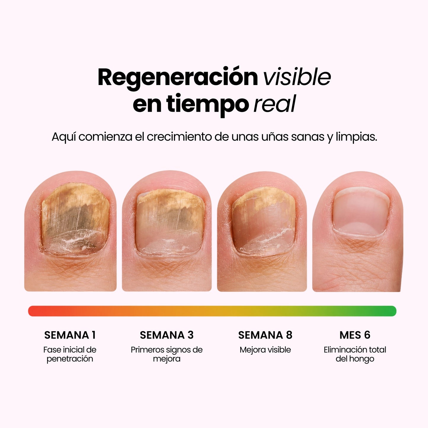 Lápiz Reparador para Uñas | Nolynails™